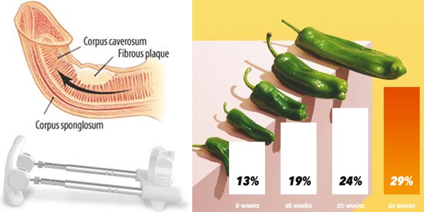 SizeGenetics Results